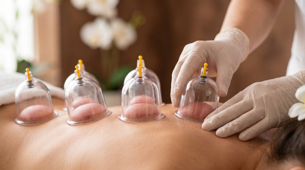 Schröpfmassage / Moxa